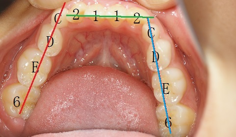 歯列の見方 ２.jpg